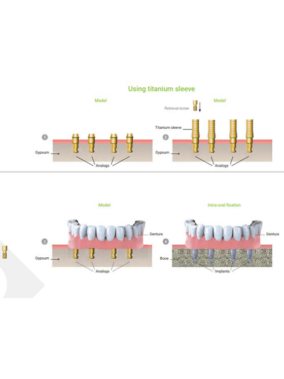 analogue-pour-pilier-multi-unit-3751.png