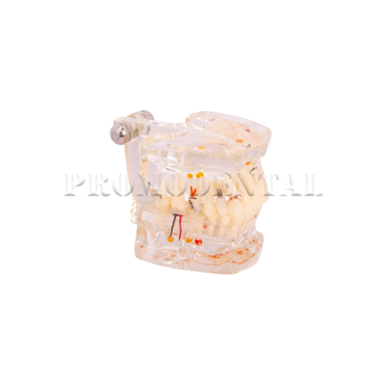 173-A0015-Pathology-Model-with-half-implant-173-A0015-2