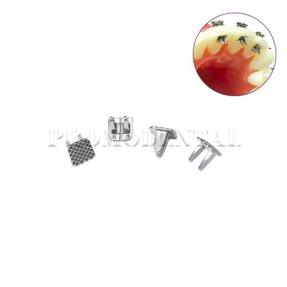 charni-re-de-langue-coller-4170